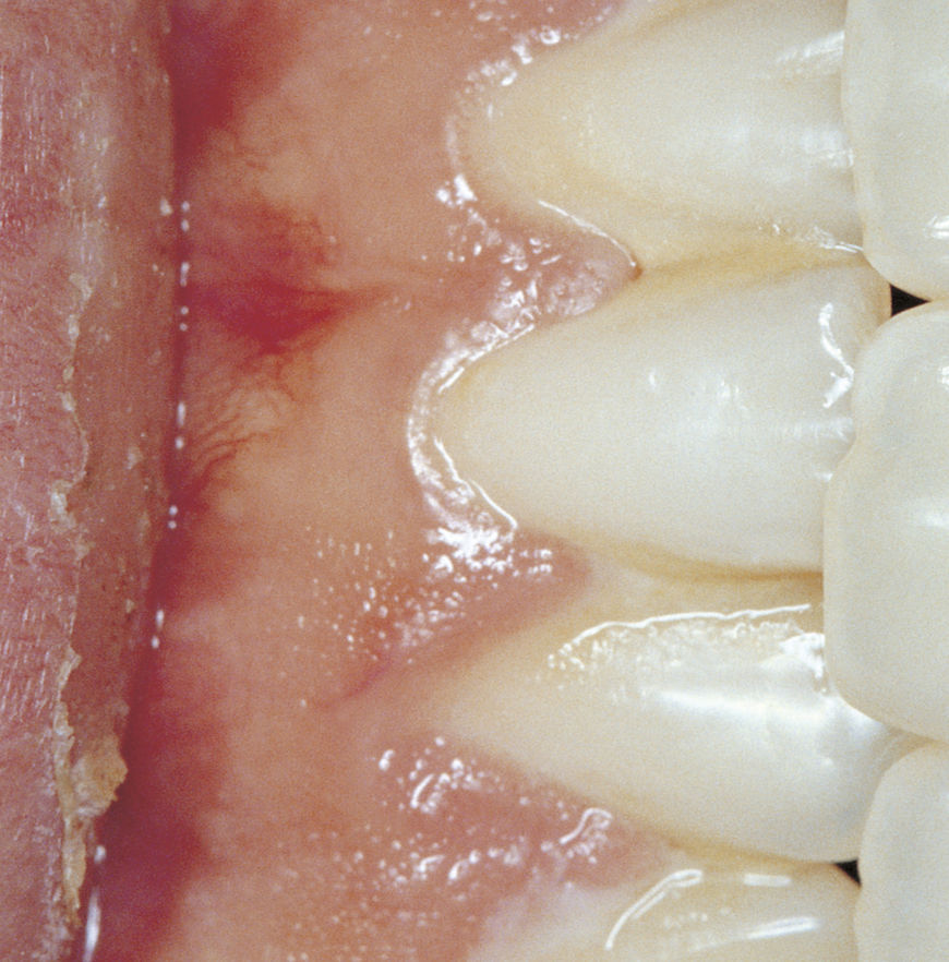 IMAGE: Photography – teeth